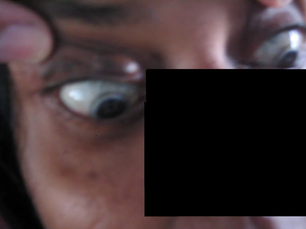 Schempp Hirth Flugzeugbau Gmbh ARCUS M